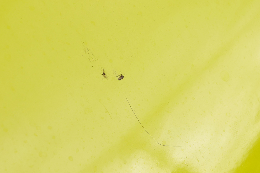 ボディについた虫の跡